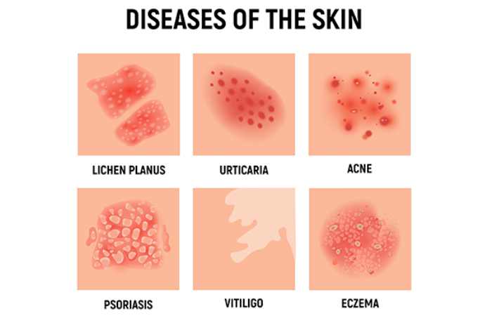 skin rash about
